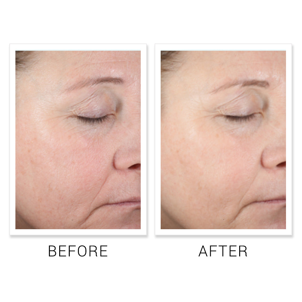 Ultra Hydrating HA Serum